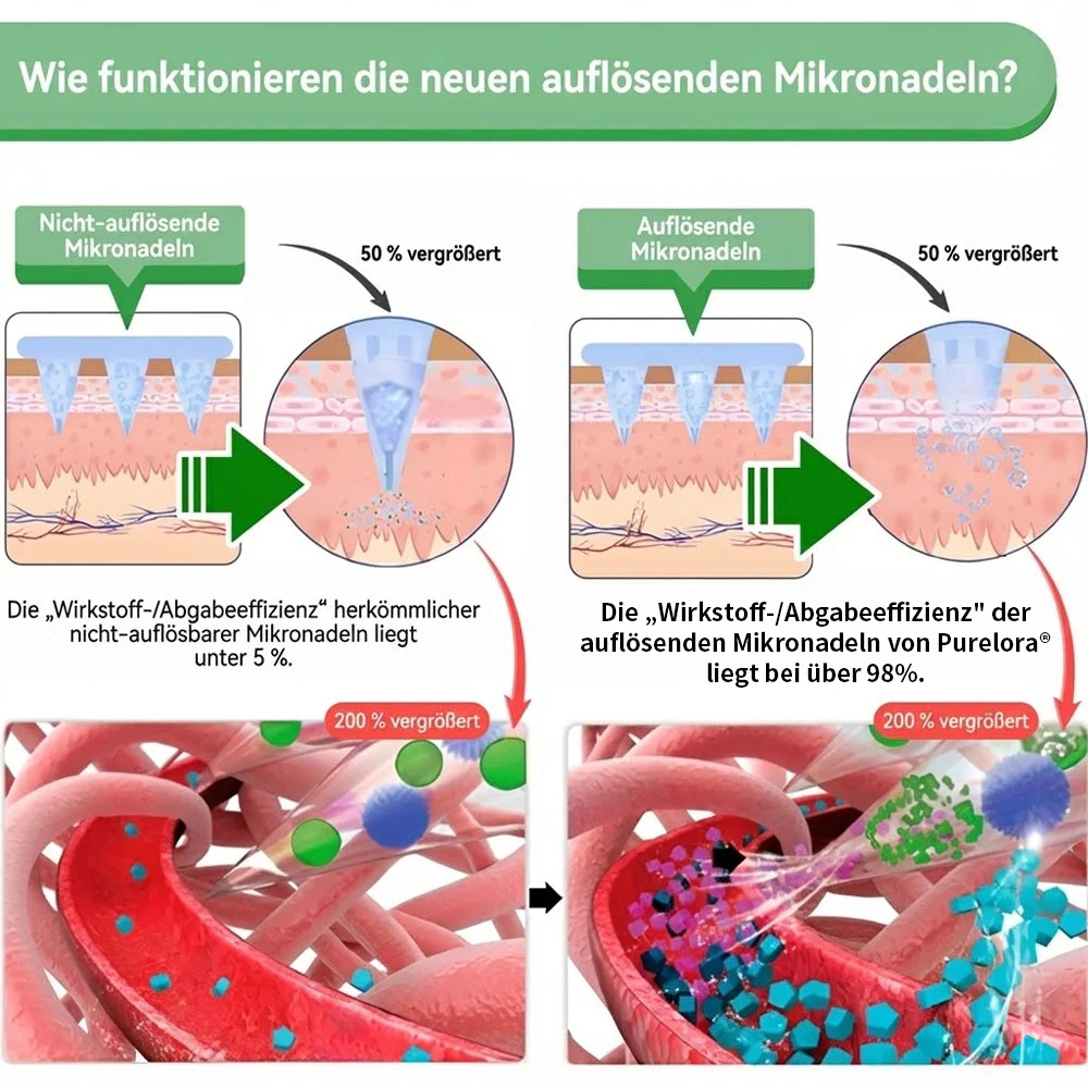 🔥 Offizieller Bestseller丨Purelora® Moringa Berberine x NAD+ 10-in-1 Nano-Mikronadel-Patch (Nur einmal täglich, sichtbare Veränderungen in 7 Tagen) ✅ Für Übergewicht, lockere Haut, Diabetes, Schlafapnoe, Gelenkprobleme und mehr - Image 5